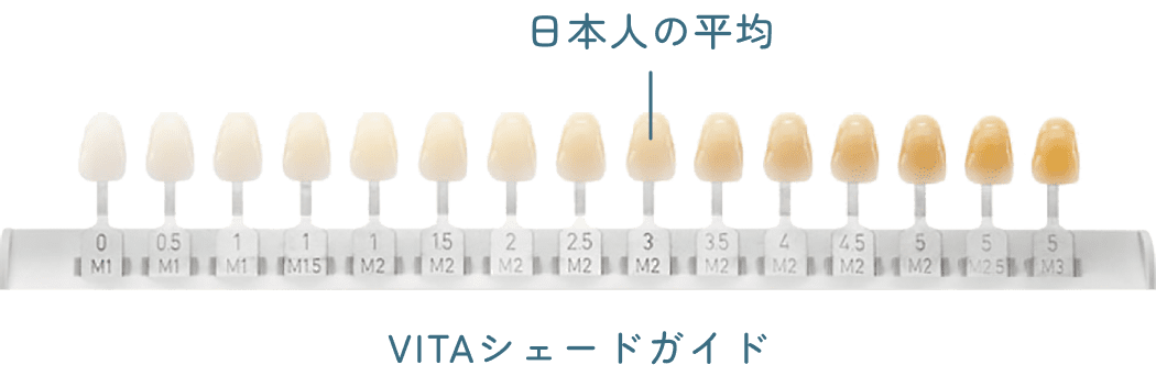 VITAシェードガイド（歯の色見本）と日本人の歯の平均的な色味